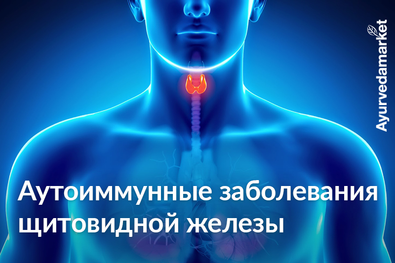 Аутоиммунные заболевания щитовидной железы: гипотиреоз и гипертиреоз сточки зрения Аюрведы - Аюрведа-маркет